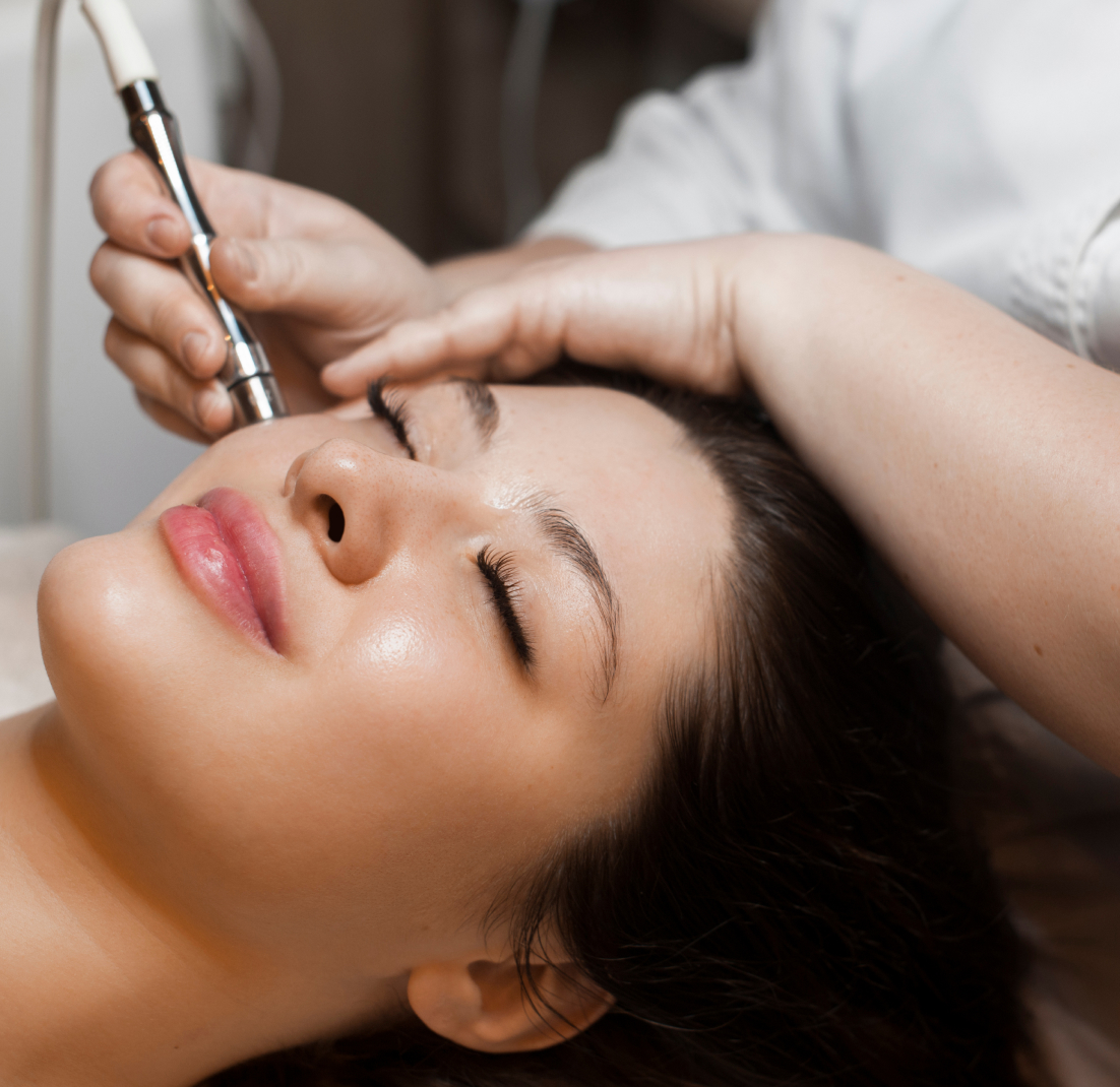 Microneedling