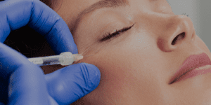 Woman receiving a PRFM treatment at Vigour Aesthetics + Wellness Albany, NY medspa.