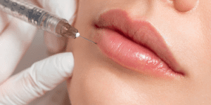 Filler treatments are available at Vigour Aesthetics + Wellness, a premier med spa in Albany, NY