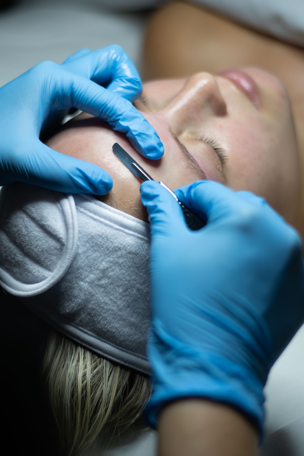 esthetician wearing blue gloves performing dermaplaning with a scalpel on a woman's cheek to exfoliate dead skin and remove peach fuzz