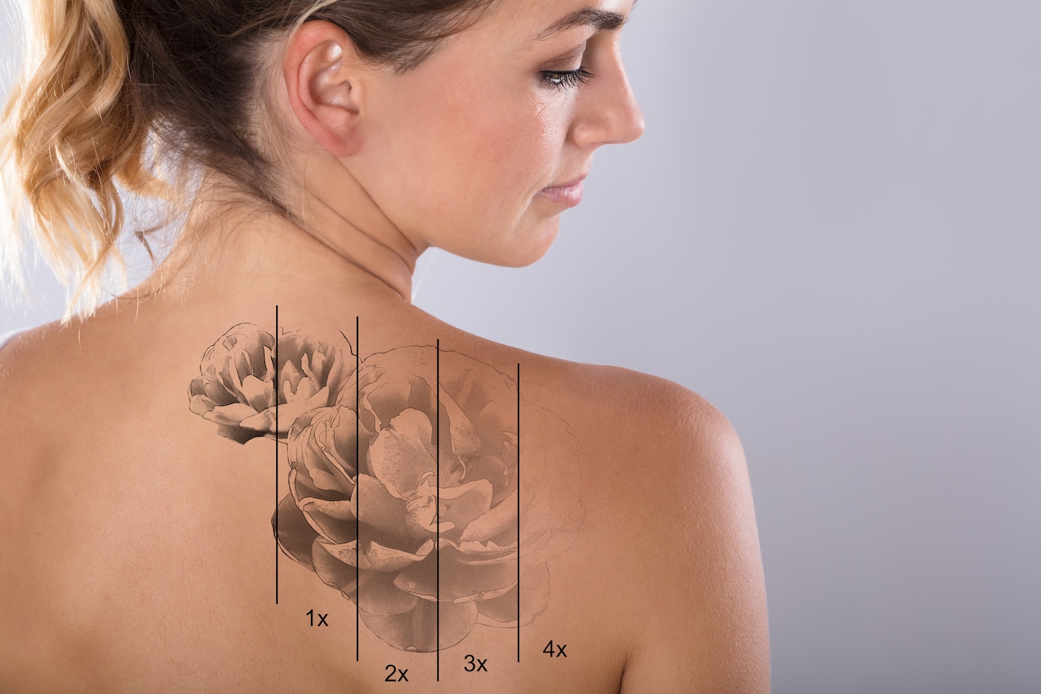 a woman looks over her shoulder showing a floral tattoo with four vertical sections labeled 1x to 4x, illustrating progressive fading