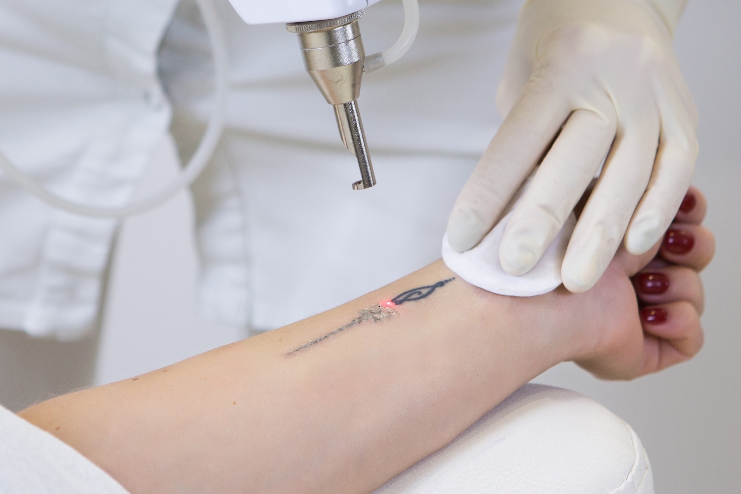 gloved hands holding a laser device above a small black wrist tattoo while applying a cotton pad
